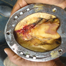 Sole injury management